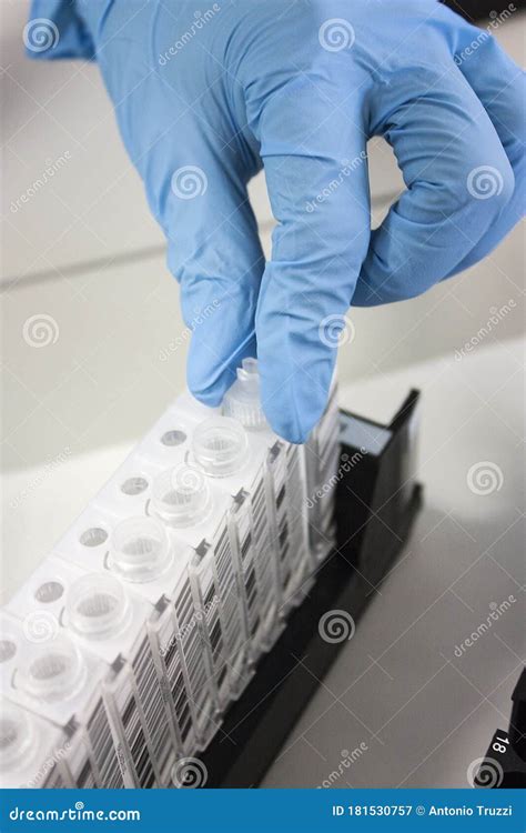 Preparation of Racks with Test Tubes for Medical Laboratory Analysis Editorial Photography ...