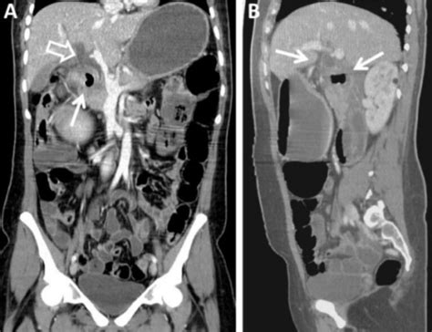 Computed Tomography (CT) | Concise Medical Knowledge