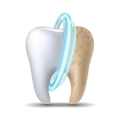 Smile Brighter: The Ultimate Guide to Teeth Whitening. - Medspurs