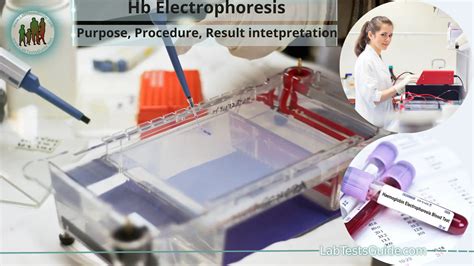 Hb Electrophoresis Test Purpose, Procedure, Result intetpretation and more