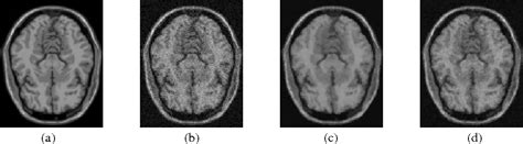 Figure 1 from Hardware accelerated rician denoise algorithm for high performance magnetic ...