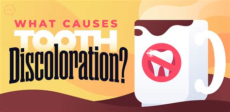 Tooth Discoloration Causes - Los Altos Dental Excellence