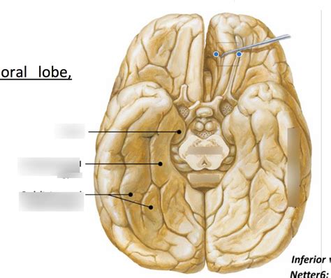 Ventral surface of brain Diagram | Quizlet