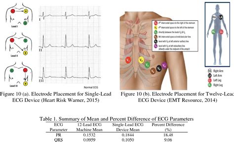 Table 1 from IoT: Electrocardiogram (ECG) Monitoring System | Semantic Scholar