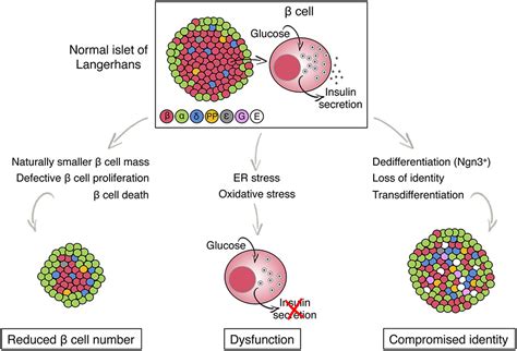 Frontiers | Metabolic Stress and Compromised Identity of Pancreatic ...