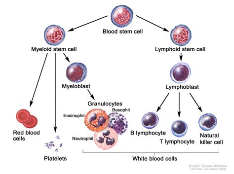 Acute Lymphoblastic Leukemia Pathophysiology