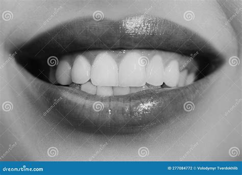 Laughing Woman Mouth with Great Teeth. Perfect Smile after Bleaching ...