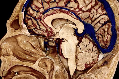 Mid-Sagittal Perspective of Right Hemisphere, Brainstem, and Cerebellum | Neuroanatomy | The ...