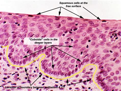 Stratified Squamous Epithelium: Dead Outermost Cells And Living Inner ...