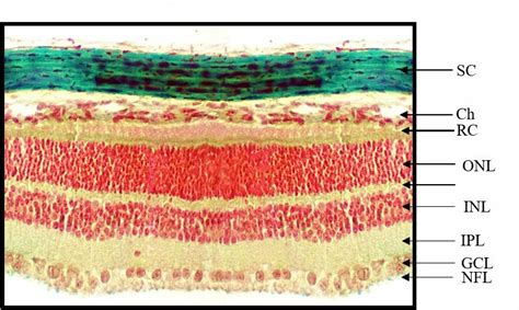 Microphotograph of Retina Illustrated the Histological... | Download Scientific Diagram