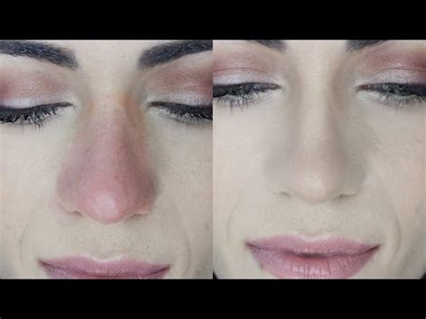 Best Makeup To Cover Blotchy Skin | Makeupview.co