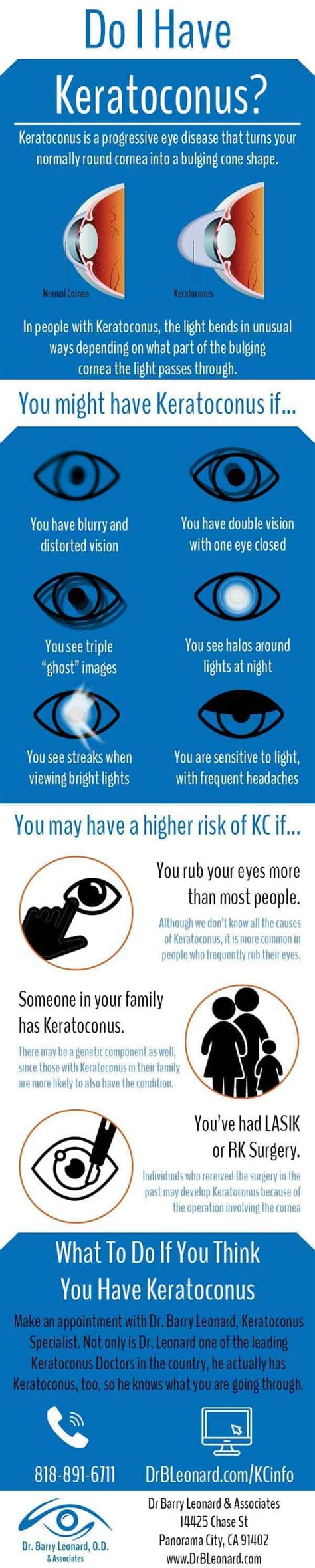 Rizzuti Sign Keratoconus