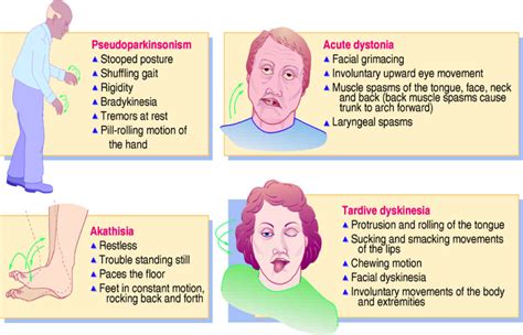 extrapyramidal symptoms - Google Search | Pharmacology nursing, Psych ...