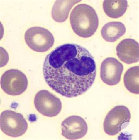 Eosinophil