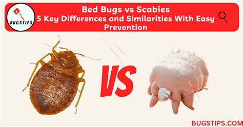 Bed Bugs vs Scabies - 5 Key Differences and Similarities With Easy Prevention - BugsTips