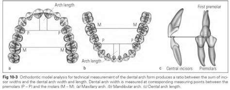 Orthodontic Model Analysis - Dental Technology: How-To, Tips