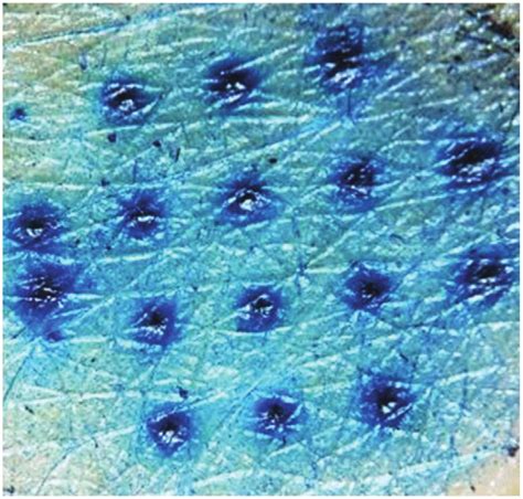 Skin penetration was assessed using methylene blue dye staining and an ...