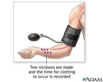 Blood clot test: MedlinePlus Medical Encyclopedia Image