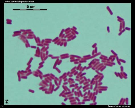 Enterobacter cloacae light microscopy