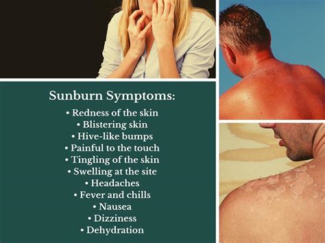 Symptoms of Sun Poisoning and Sunburn