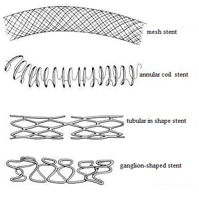 Types of stents [49] | Download Scientific Diagram