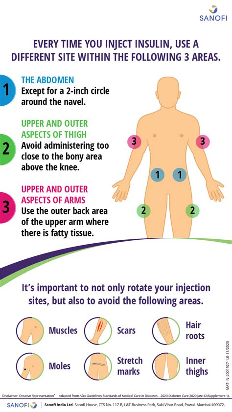 Insulin Injection Sites Diagram Printable