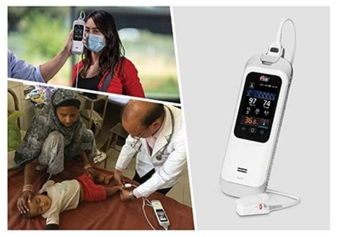 Masimo gets CE mark for Rad-G with Temperature handheld device