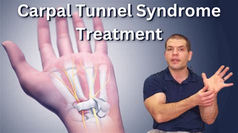 Carpal Tunnel Syndrome Treatment | Avoid Carpal Tunnel Surgery