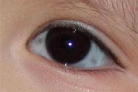 Blue Spot In Eye | Goldenacresdogs.com