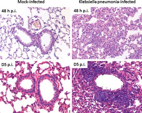 Significant lung pathology in Klebsiella pneumonia infected animals.... | Download Scientific ...