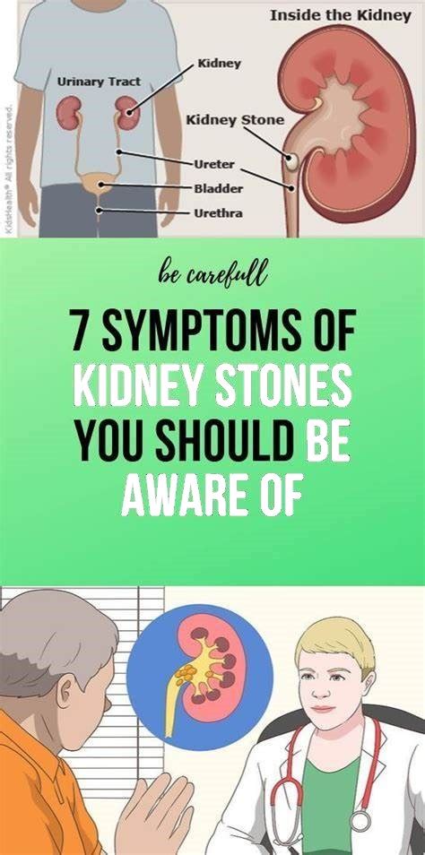 7 Symptoms of Kidney Stones You Should be Aware of - wellness magazine