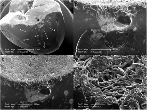 Replica fractographic analysis of a 12 months chip-fracture of a... | Download Scientific Diagram