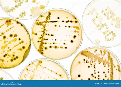 Growing Bacteria in Petri Dishes on Agar Gel Scientific Experiment Stock Image - Image of plate ...