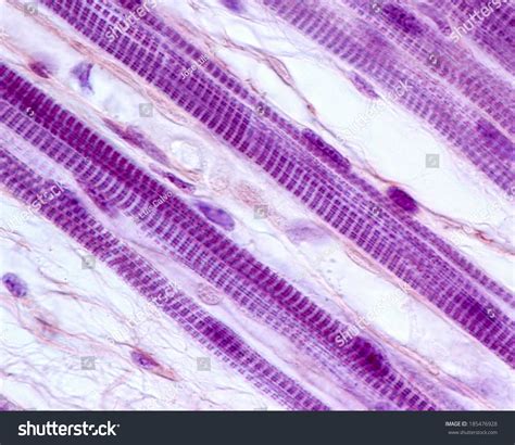 Skeletal Muscle Fibers Showing Striated Myofibrils Stock Photo 185476928 - Shutterstock