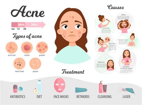 12,700+ Acne Stock Illustrations, Royalty-Free Vector Graphics & Clip Art - iStock