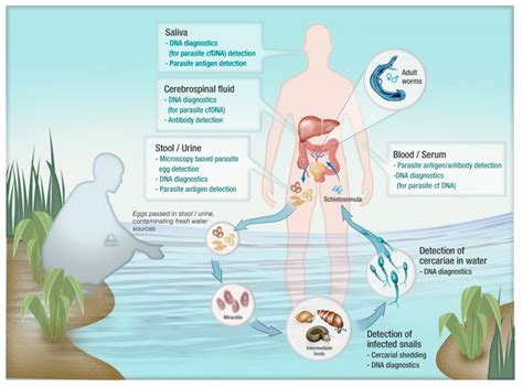 Schistosomiasis Parasite Eggs