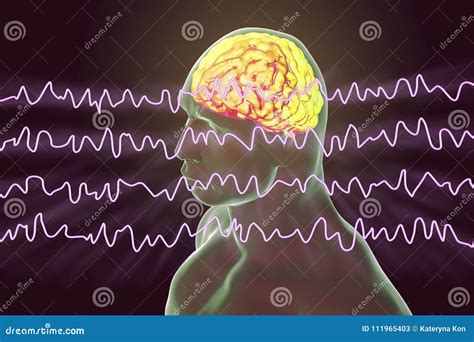 EEG Electroencephalogram, Brain Wave in Awake State during Rest Stock ...