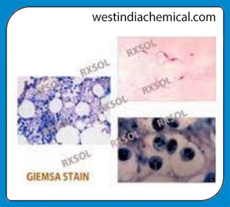 GIEMSA STAIN FOR MICROSCOPY | West India ChemicalsEstd.1995