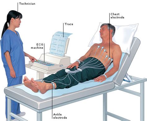 ECG - Dr Anand Diagnostics