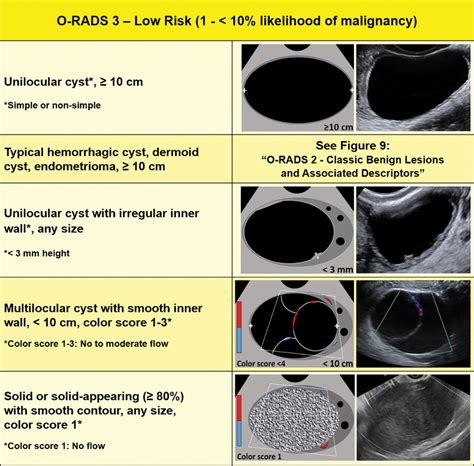 O rads us risk stratification and management system a consensus ...