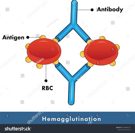 Hemagglutination Assay Used Blood Grouping Blood Stock Vector (Royalty ...