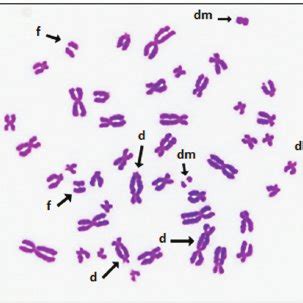 Metaphase plates obtained from culture of human blood cells. ( A )... | Download Scientific Diagram