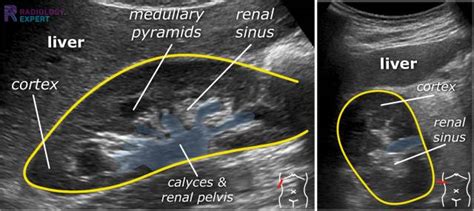 Abdominal ultrasound