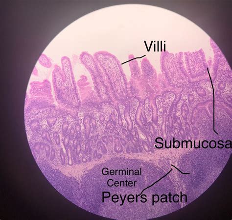 Peyer's Patch Histology.