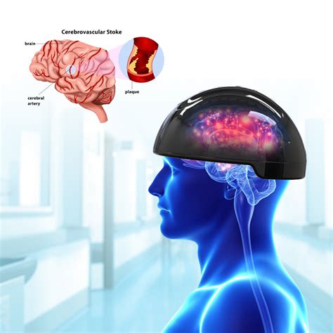 Suyzeko 810nm LED Light Therapy Brain Photobiomodulation Helmet for ...