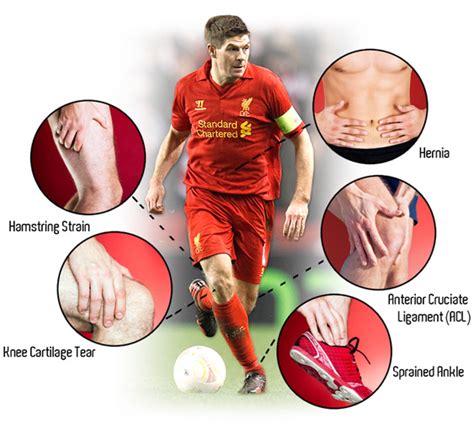 Predictive modelling of football injuries - The Data Scientist