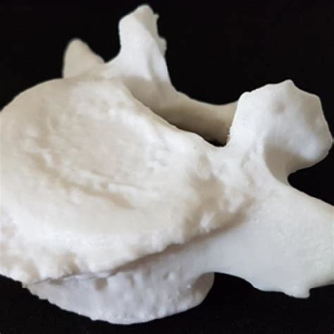 A 3D printed model of a lumbar vertebra showing osteophytic lipping. | Download Scientific Diagram