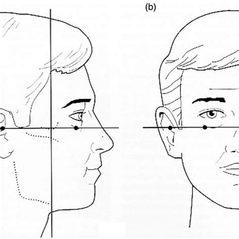 Position of the Frankfort Horizontal. | Download Scientific Diagram