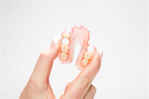 What Are Flexible Partial Dentures? - TORRENS DENTAL CARE