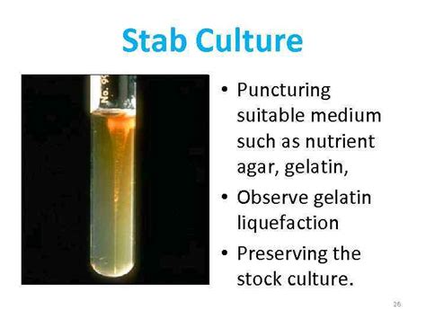 Bacterial Culture Methods By Konrad T Juszkiewicz MD